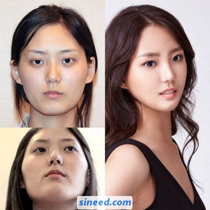 new-face-of-korean-women-04.jpg